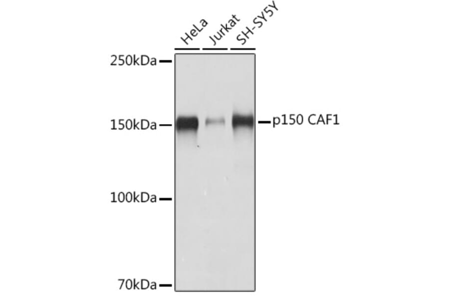 Western Blot - Anti-p150 CAF1/CAF Antibody [ARC2011] (A308038) - Antibodies.com