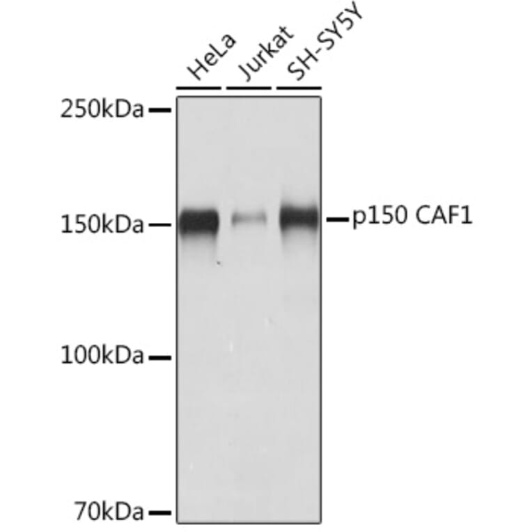 Western Blot - Anti-p150 CAF1/CAF Antibody [ARC2011] (A308038) - Antibodies.com