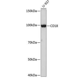 Western Blot - Anti-CD18 Antibody (A308039) - Antibodies.com