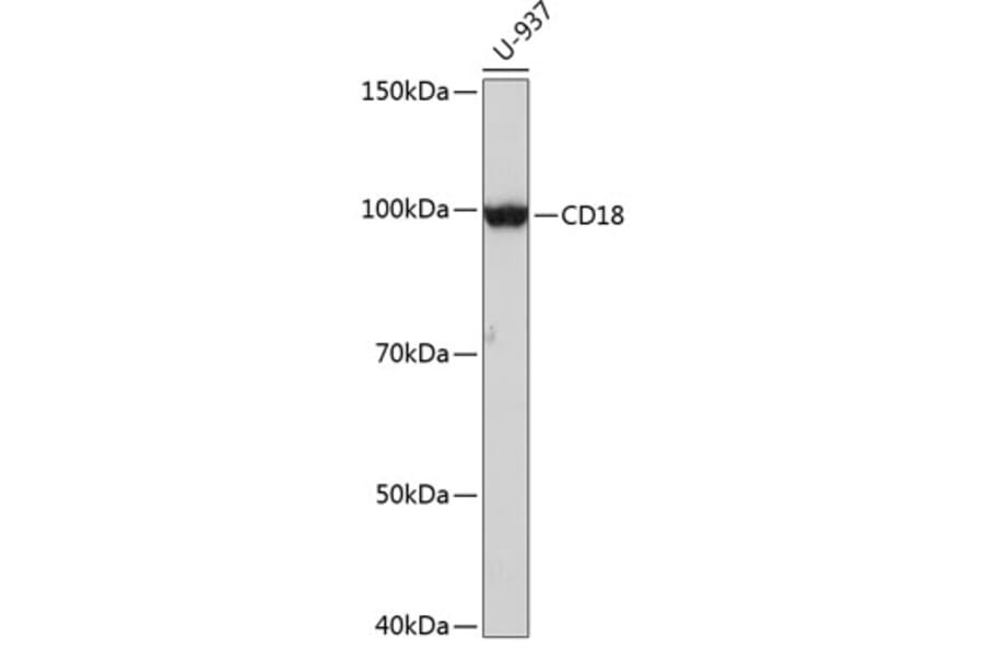 Western Blot - Anti-CD18 Antibody [ARC0400] (A308039) - Antibodies.com