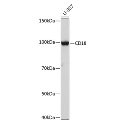 Western Blot - Anti-CD18 Antibody [ARC0400] (A308039) - Antibodies.com
