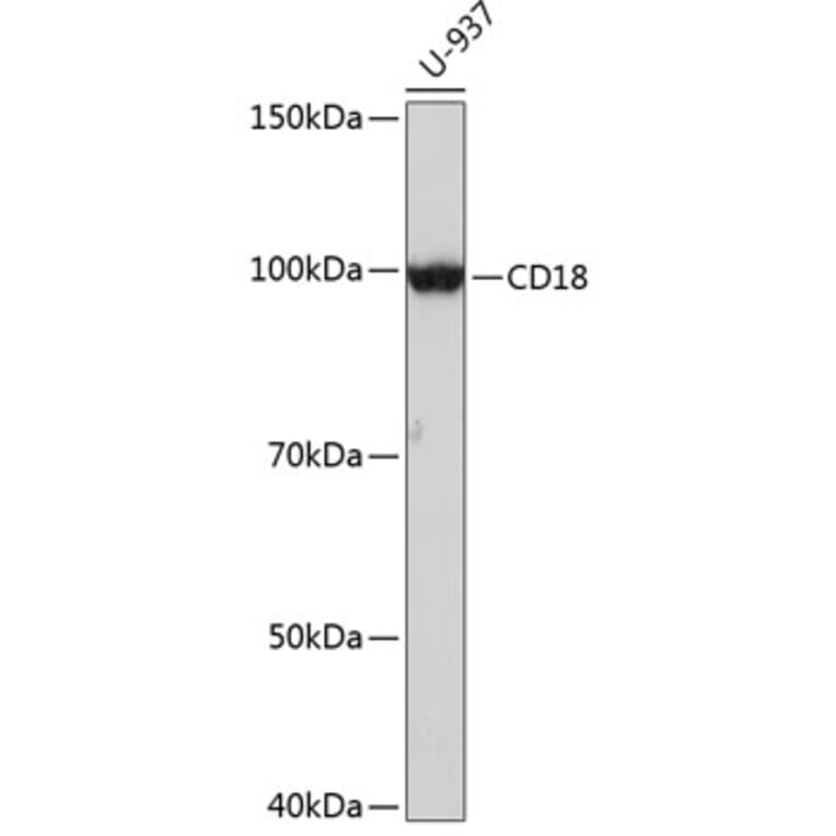 Western Blot - Anti-CD18 Antibody [ARC0400] (A308039) - Antibodies.com