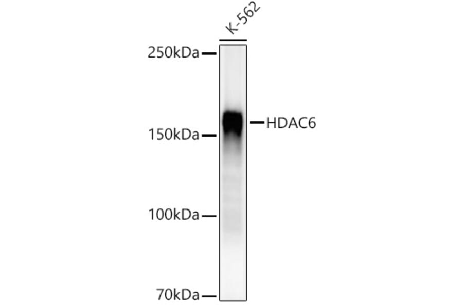 Western Blot - Anti-HDAC6 Antibody [ARC55934] (A308040) - Antibodies.com