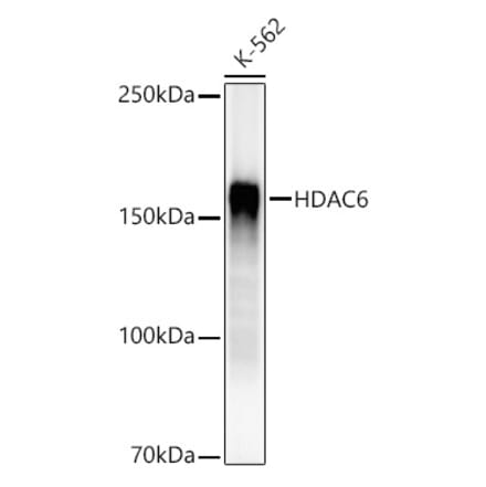 Western Blot - Anti-HDAC6 Antibody [ARC55934] (A308040) - Antibodies.com