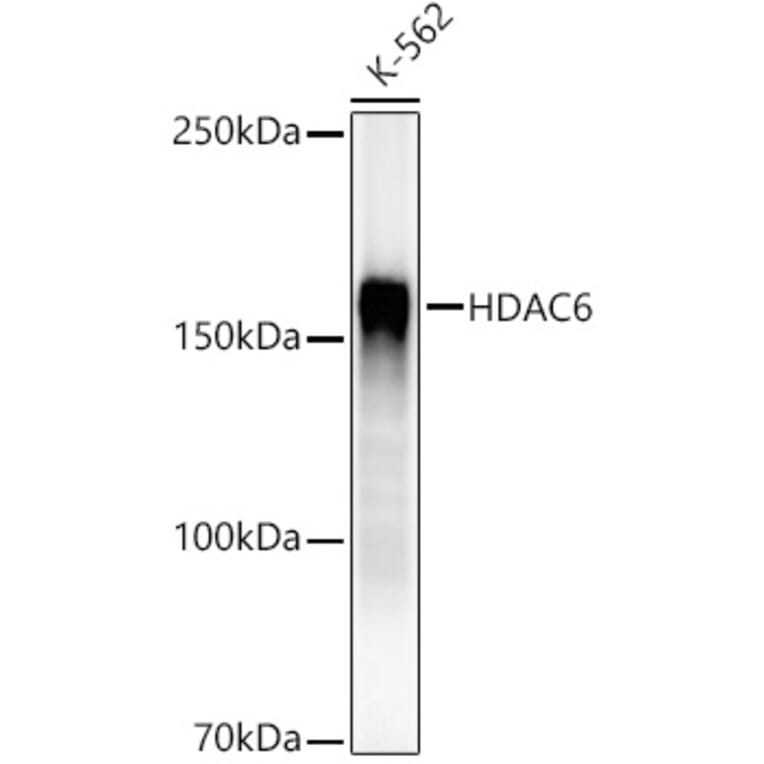 Western Blot - Anti-HDAC6 Antibody [ARC55934] (A308040) - Antibodies.com