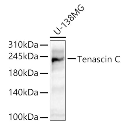 Western Blot - Anti-Tenascin C Antibody (A308041) - Antibodies.com