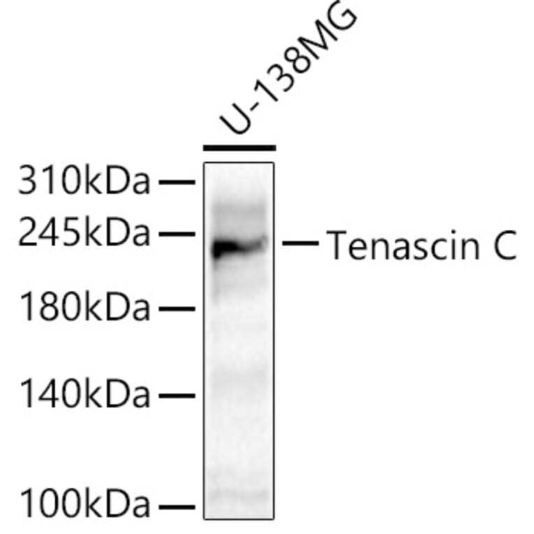 Western Blot - Anti-Tenascin C Antibody (A308041) - Antibodies.com