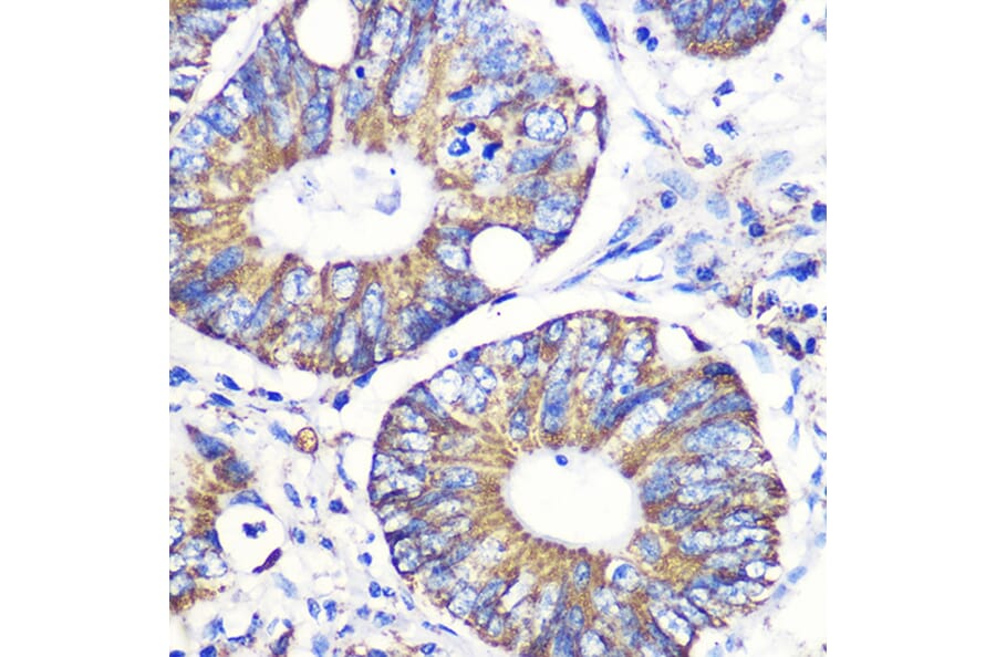 Immunohistochemistry - Anti-Tenascin C Antibody (A308041) - Antibodies.com