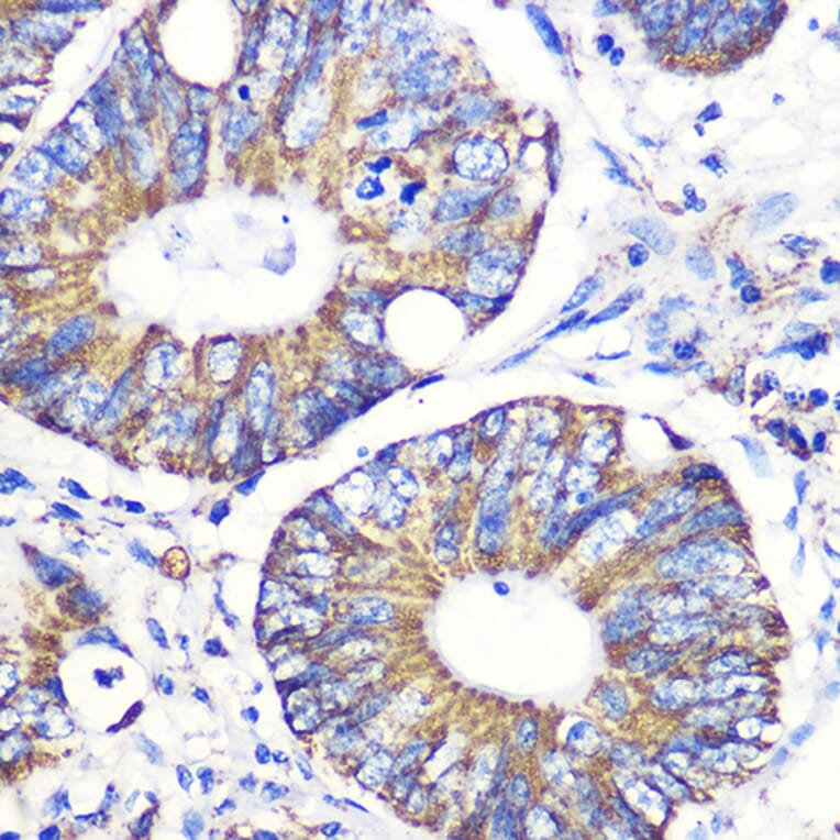 Immunohistochemistry - Anti-Tenascin C Antibody (A308041) - Antibodies.com