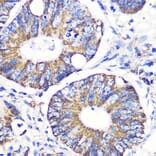 Immunohistochemistry - Anti-Tenascin C Antibody (A308041) - Antibodies.com