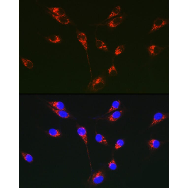 Immunofluorescence - Anti-Tenascin C Antibody (A308041) - Antibodies.com