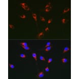 Immunofluorescence - Anti-Tenascin C Antibody (A308041) - Antibodies.com