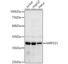 Western Blot - Anti-MRPS31 Antibody [ARC2914] (A308042) - Antibodies.com