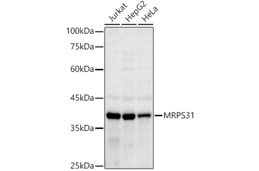 Western Blot - Anti-MRPS31 Antibody [ARC2914] (A308042) - Antibodies.com