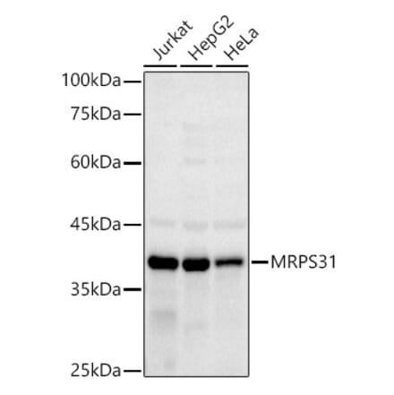 Western Blot - Anti-MRPS31 Antibody [ARC2914] (A308042) - Antibodies.com