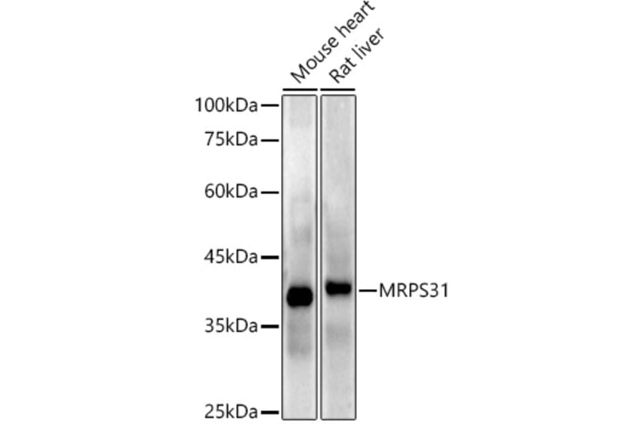 Western Blot - Anti-MRPS31 Antibody [ARC2914] (A308042) - Antibodies.com