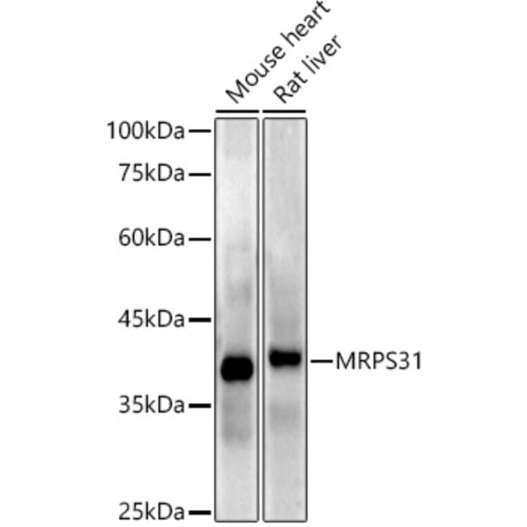 Western Blot - Anti-MRPS31 Antibody [ARC2914] (A308042) - Antibodies.com