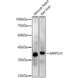 Western Blot - Anti-MRPS31 Antibody [ARC2914] (A308042) - Antibodies.com