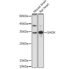 Western Blot - Anti-SHOX Antibody (A308043) - Antibodies.com