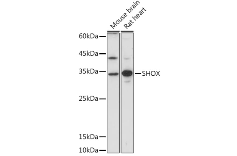 Western Blot - Anti-SHOX Antibody (A308043) - Antibodies.com