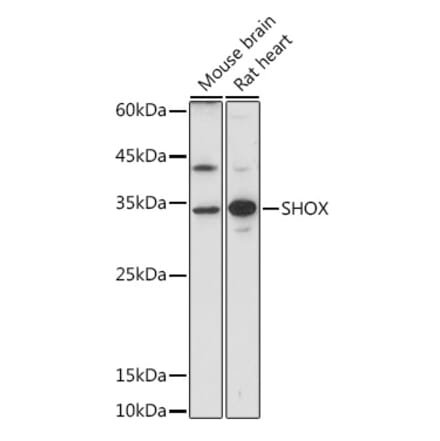 Western Blot - Anti-SHOX Antibody (A308043) - Antibodies.com