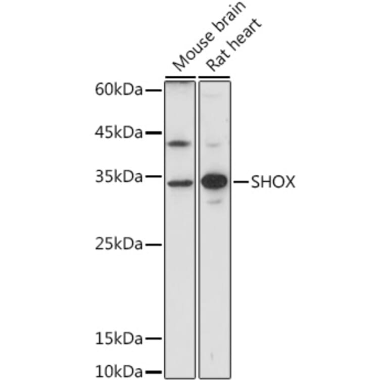 Western Blot - Anti-SHOX Antibody (A308043) - Antibodies.com