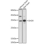 Western Blot - Anti-SHOX Antibody (A308043) - Antibodies.com