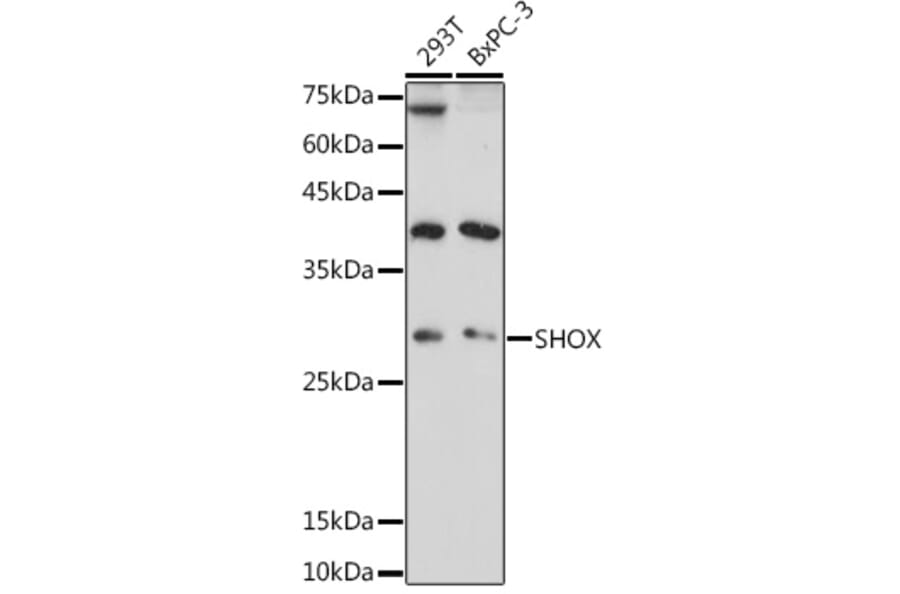 Western Blot - Anti-SHOX Antibody (A308043) - Antibodies.com