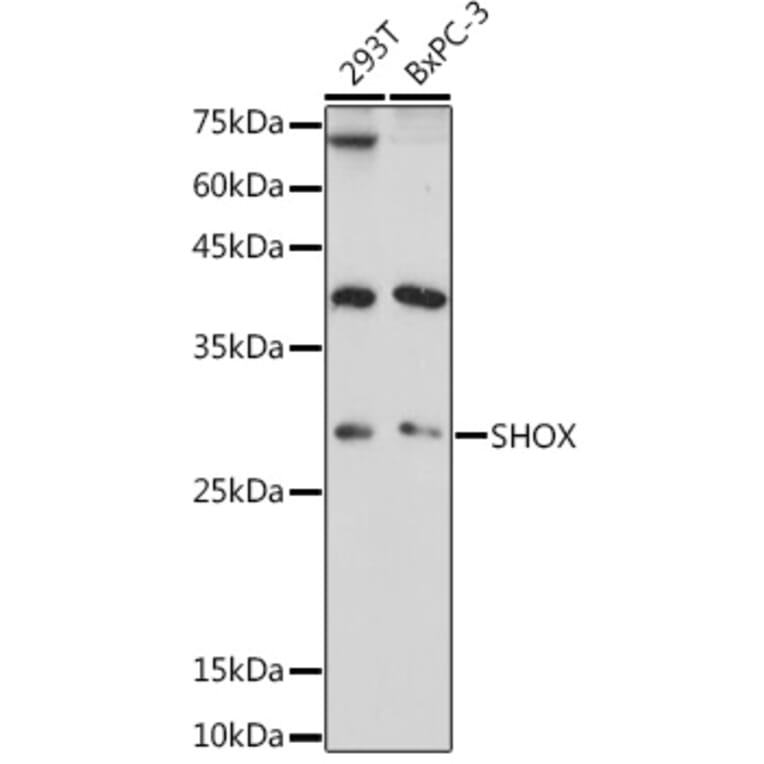 Western Blot - Anti-SHOX Antibody (A308043) - Antibodies.com