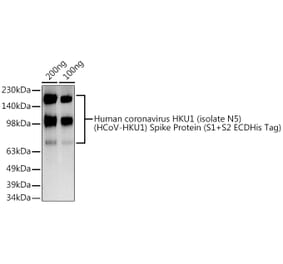 Western Blot - Anti-Human Coronavirus Spike glycoprotein Antibody (A308044) - Antibodies.com