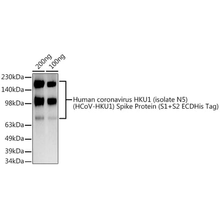 Western Blot - Anti-Human Coronavirus Spike glycoprotein Antibody (A308044) - Antibodies.com