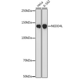 Western Blot - Anti-NEDD4-2 Antibody [ARC1404] (A308045) - Antibodies.com