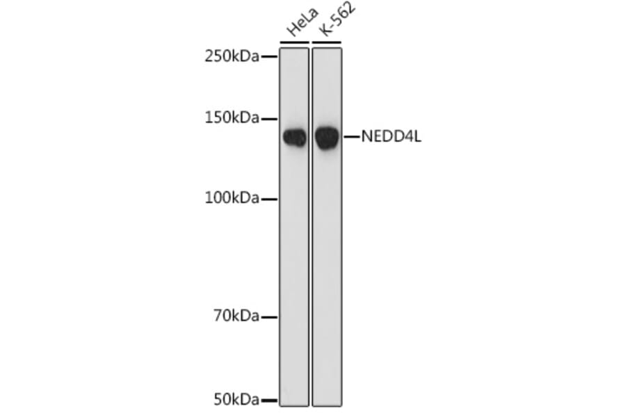 Western Blot - Anti-NEDD4-2 Antibody [ARC1404] (A308045) - Antibodies.com