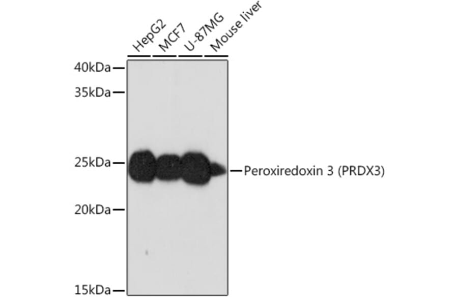 Western Blot - Anti-Peroxiredoxin 3/PRDX3 Antibody [ARC0747] (A308046) - Antibodies.com