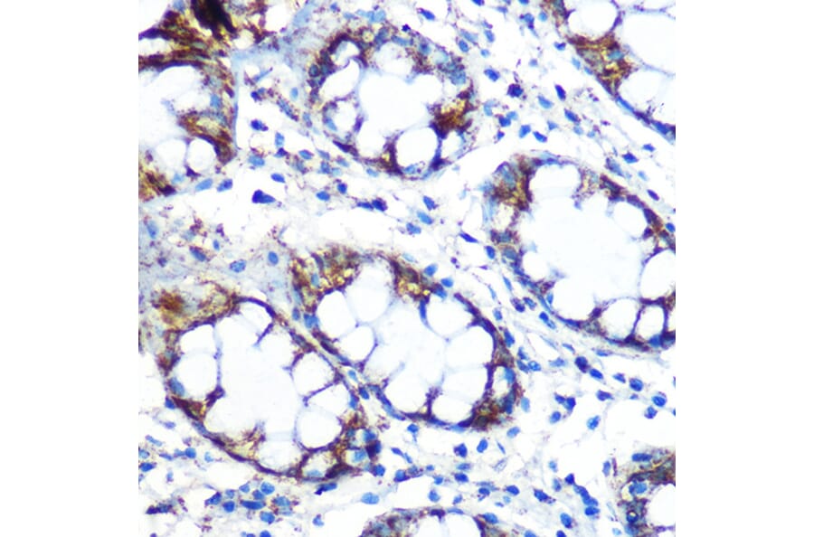 Immunohistochemistry - Anti-Peroxiredoxin 3/PRDX3 Antibody [ARC0747] (A308046) - Antibodies.com