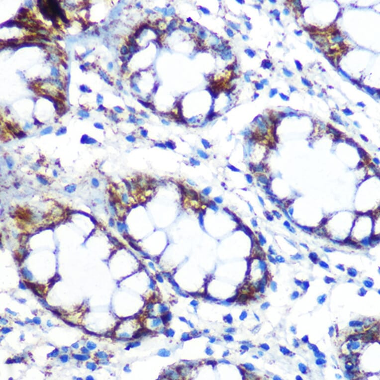 Immunohistochemistry - Anti-Peroxiredoxin 3/PRDX3 Antibody [ARC0747] (A308046) - Antibodies.com