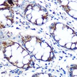 Immunohistochemistry - Anti-Peroxiredoxin 3/PRDX3 Antibody [ARC0747] (A308046) - Antibodies.com