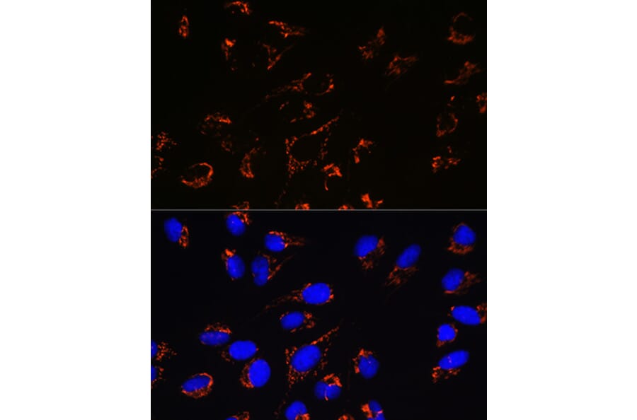 Immunofluorescence - Anti-Peroxiredoxin 3/PRDX3 Antibody [ARC0747] (A308046) - Antibodies.com