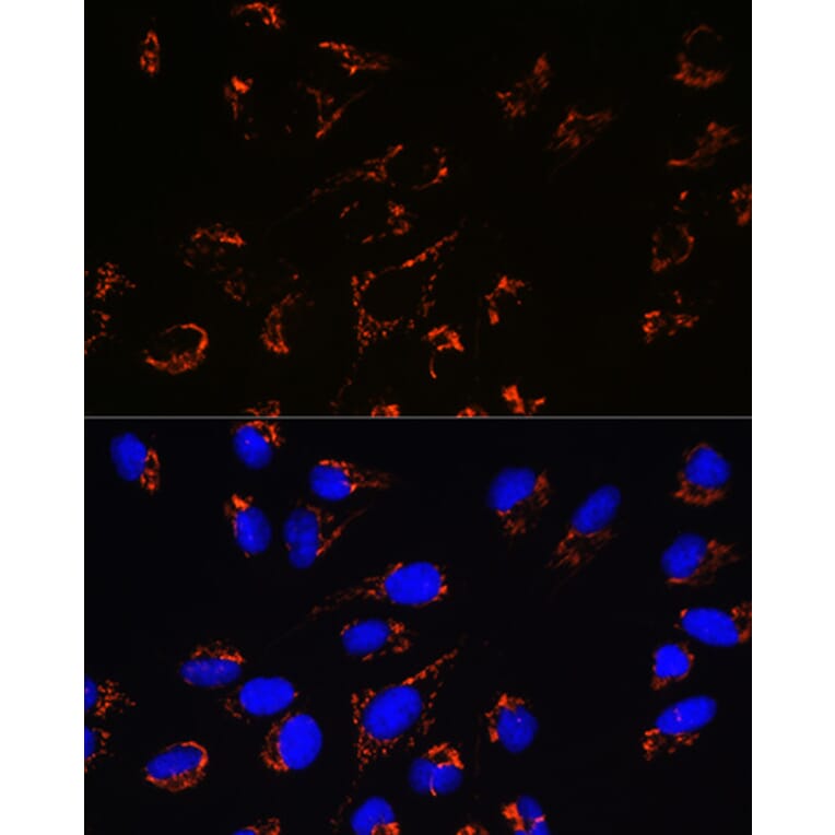 Immunofluorescence - Anti-Peroxiredoxin 3/PRDX3 Antibody [ARC0747] (A308046) - Antibodies.com