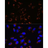 Immunofluorescence - Anti-Peroxiredoxin 3/PRDX3 Antibody [ARC0747] (A308046) - Antibodies.com