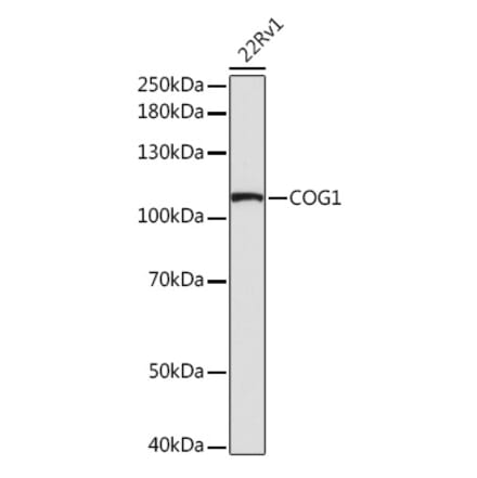 Western Blot - Anti-COG1 Antibody (A308047) - Antibodies.com