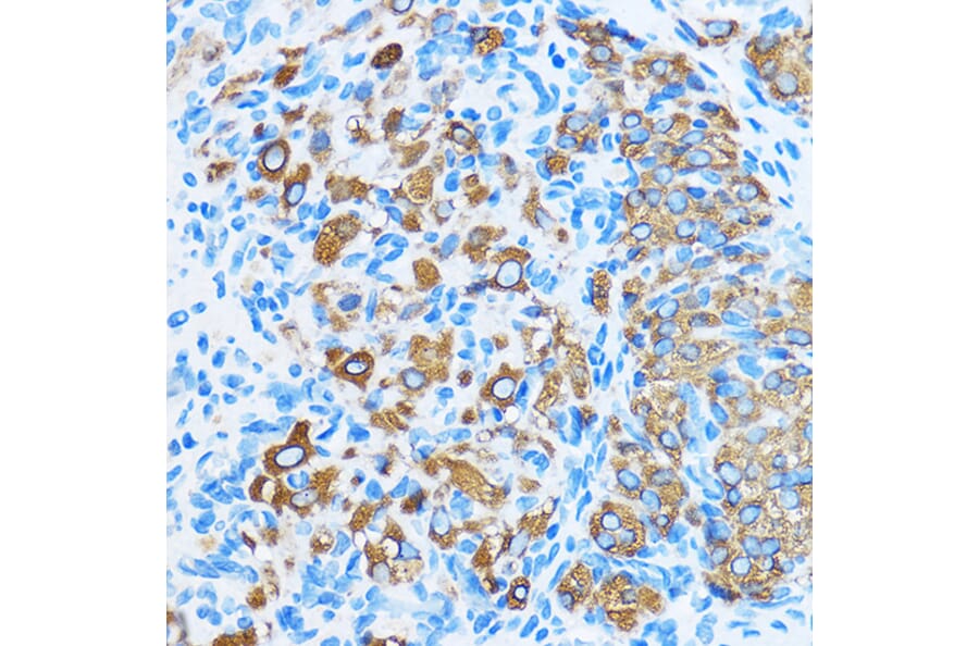 Immunohistochemistry - Anti-COG1 Antibody (A308047) - Antibodies.com