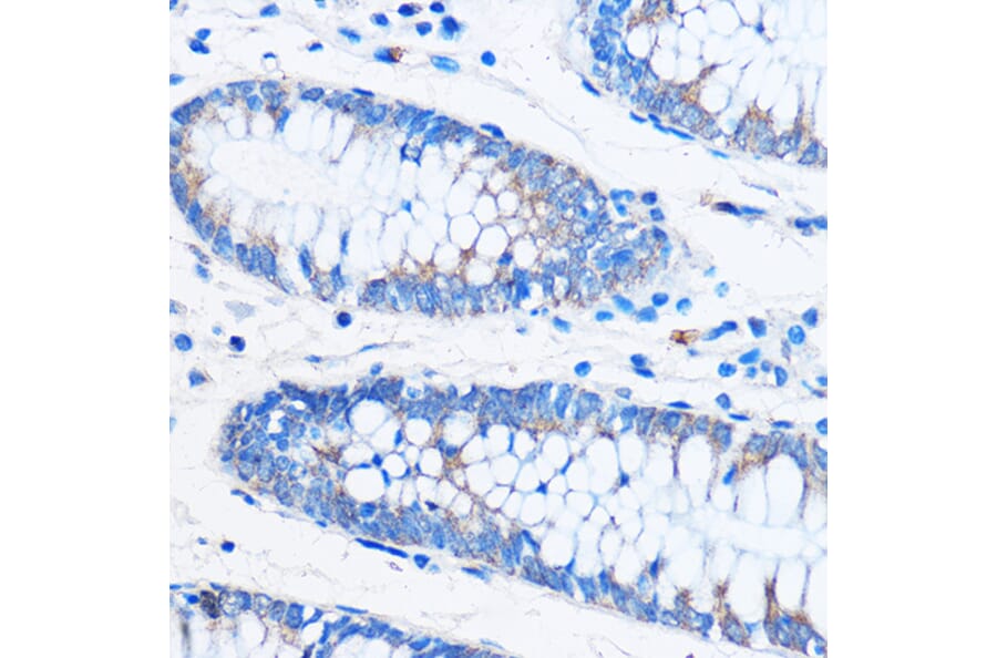 Immunohistochemistry - Anti-COG1 Antibody (A308047) - Antibodies.com