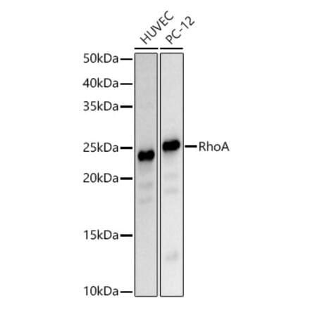 Western Blot - Anti-RhoA Antibody (A308049) - Antibodies.com