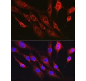 Immunofluorescence - Anti-RhoC Antibody (A308050) - Antibodies.com