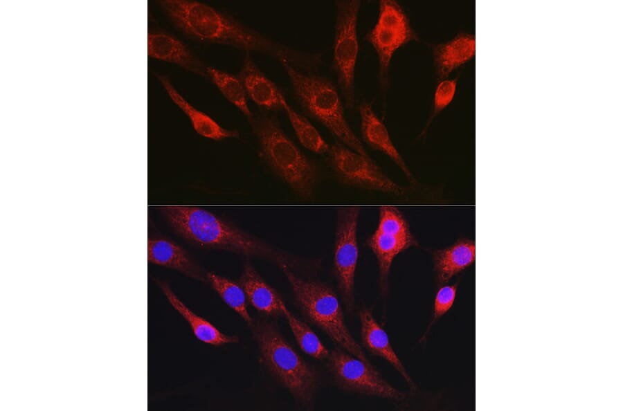 Immunofluorescence - Anti-RhoC Antibody (A308050) - Antibodies.com