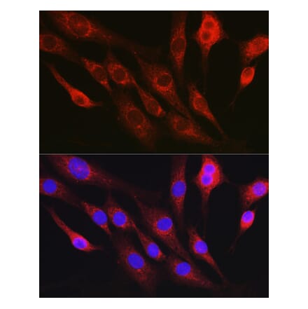 Immunofluorescence - Anti-RhoC Antibody (A308050) - Antibodies.com