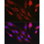 Immunofluorescence - Anti-RhoC Antibody (A308050) - Antibodies.com