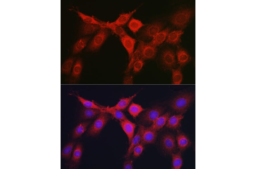 Immunofluorescence - Anti-RhoC Antibody (A308050) - Antibodies.com