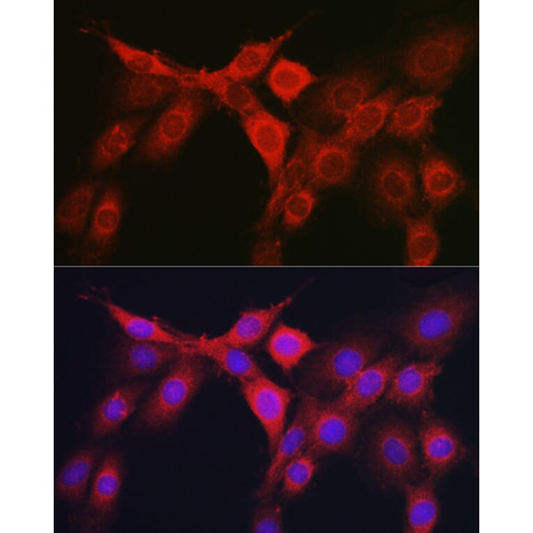 Immunofluorescence - Anti-RhoC Antibody (A308050) - Antibodies.com